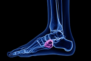 Causes and Location of Cuboid Syndrome