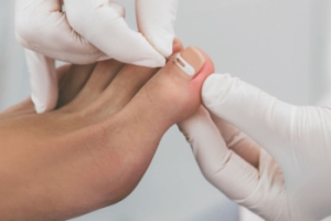 Treatment Options for Ingrown Toenails